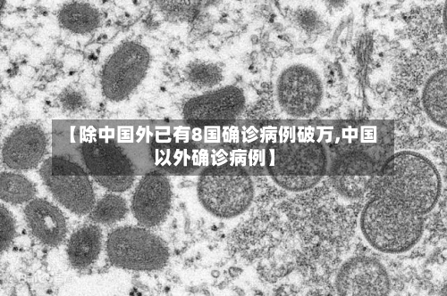 【除中国外已有8国确诊病例破万,中国以外确诊病例】