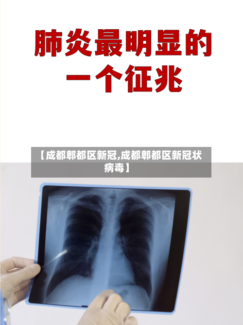【成都郫都区新冠,成都郫都区新冠状病毒】