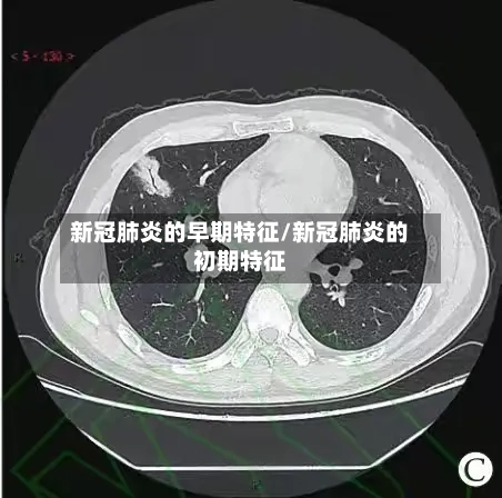 新冠肺炎的早期特征/新冠肺炎的初期特征
